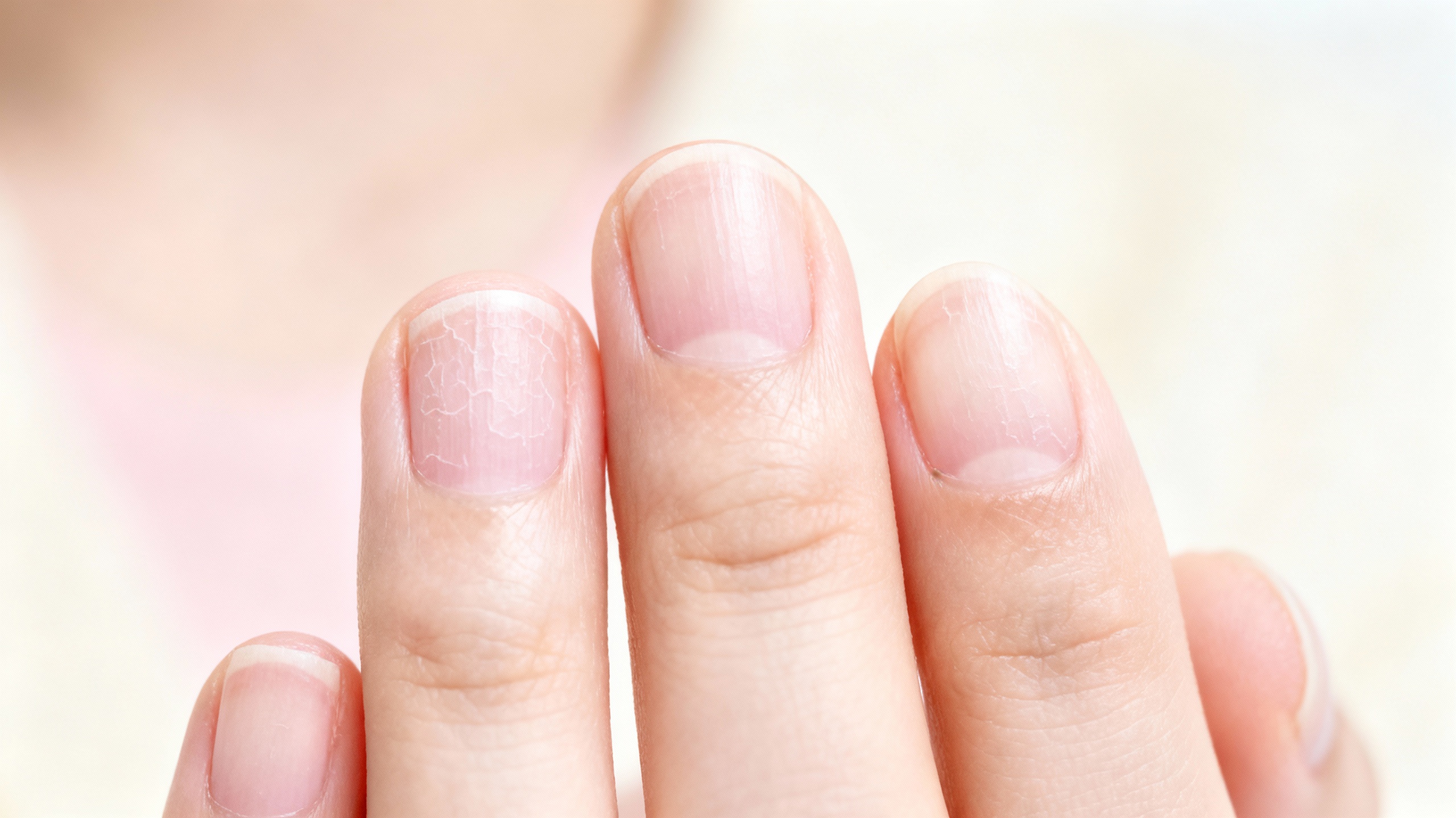Featured image for Powdery Nails: Symptoms and Treatment