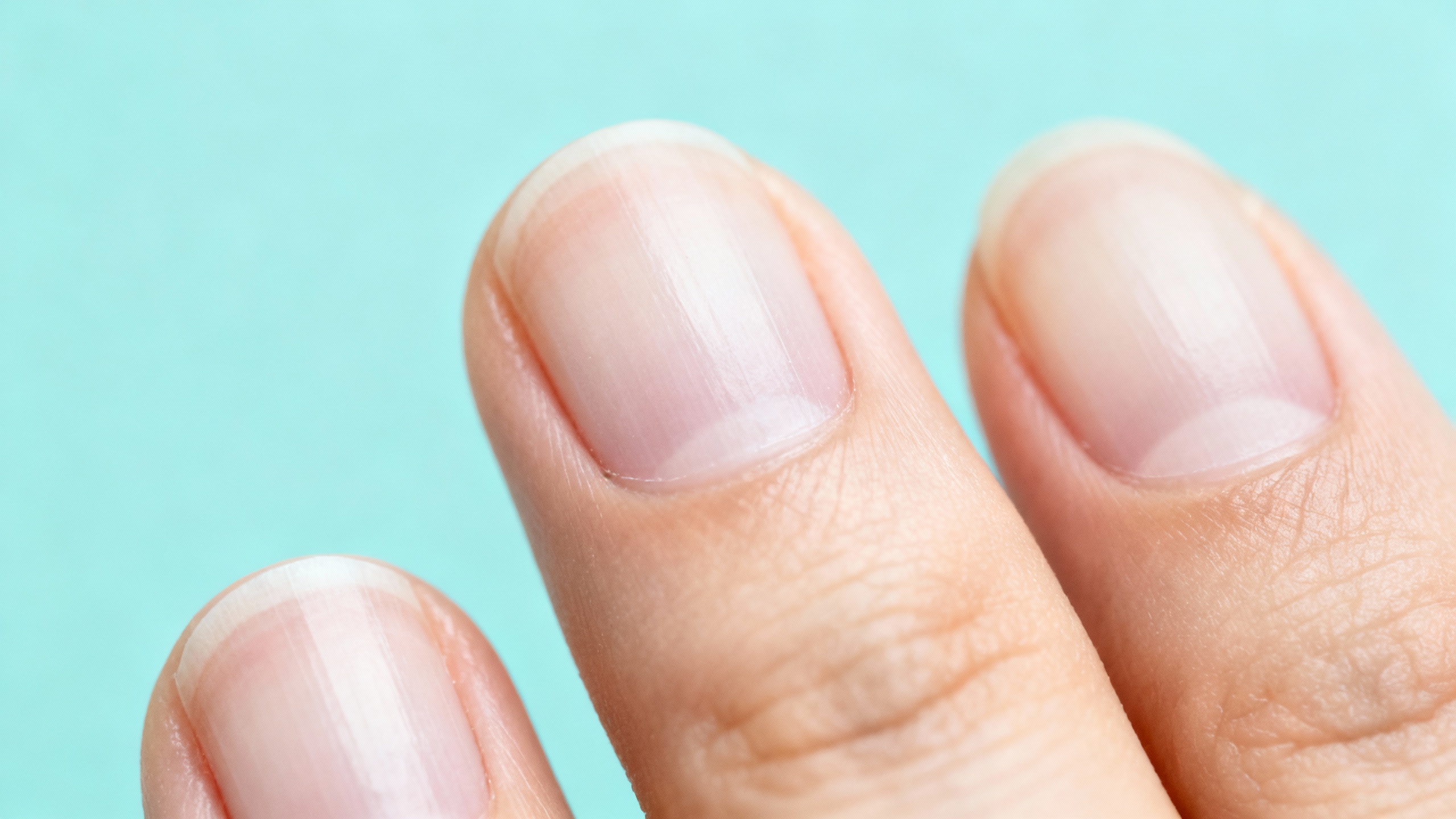Featured image for Don’t Let Thickened Nails Get You Down: What You Need to Know about Onychomycosis